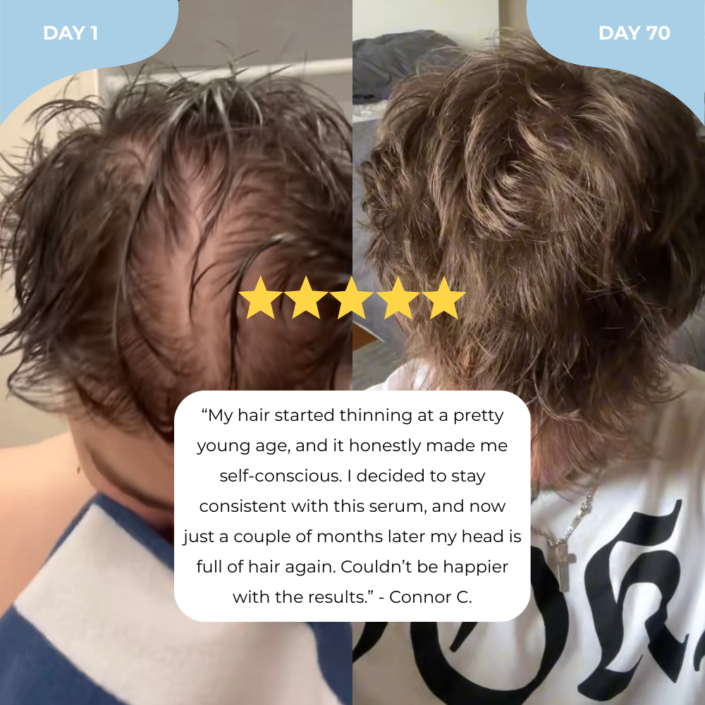 Soporla Hair Growth Serum Roll-On